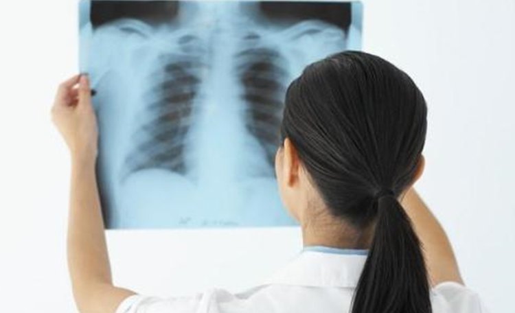 Quixeramobim: Ouvinte afirma que foi mal atendido na Secretaria de Saúde e relata que serviço de raio-x da policlínica não está funcionando