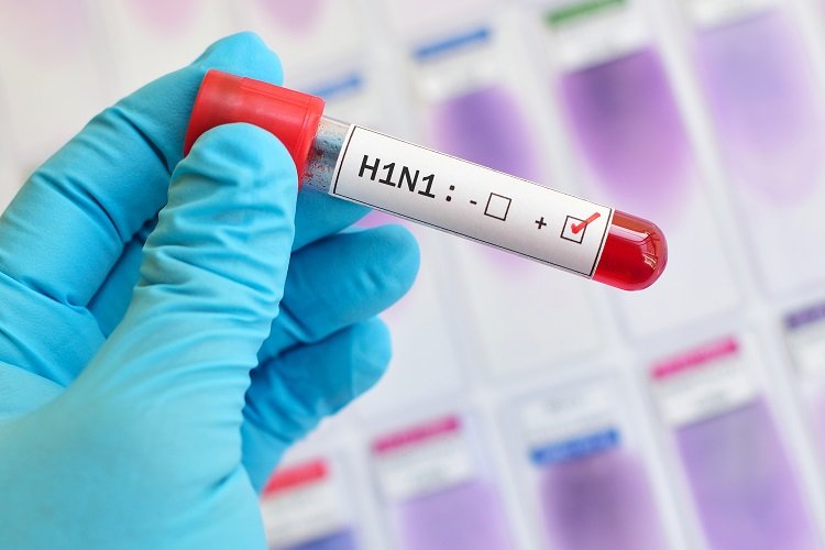 H1N1: Número de mortes sobe para 27 em 2018