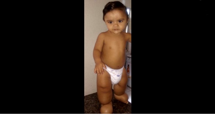 SerTão TV: Dona de casa cobra consultas para seu filho que sofre de doença congênita