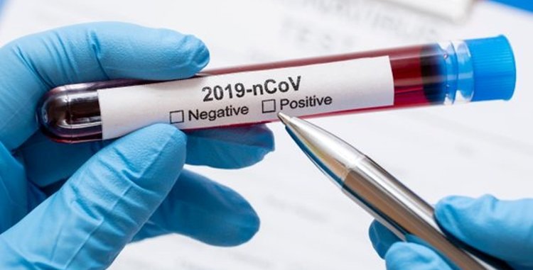 data-12032020---profissional-em-laboratorio-realiza-teste-de-coronavirus-freepik-205808-article