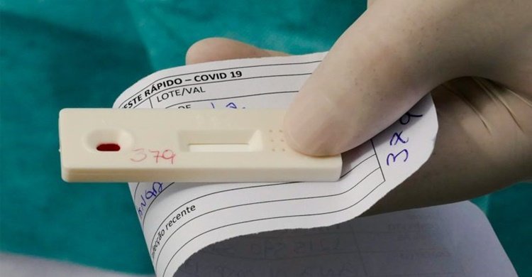 teste-rapido-coronavirus-covid-flickr-senado-federal-800x450