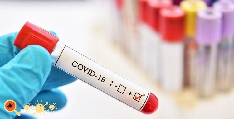 Mundo tem quase 20 milhões de casos confirmados de Covid-19