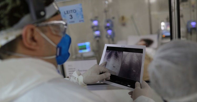 _radiografia_de_torax_coronaviruscovid-19_hospital_sao_paulo1205200326