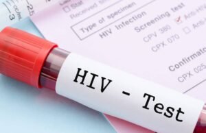 Brasil amplia tratamento para pacientes com aids e resistência a antirretrovirais