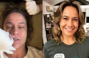 Paralisia de Bell: estresse pode desencadear paralisia facial que acometeu Fernanda Gentil