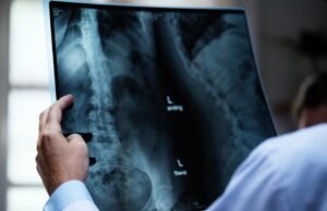 Junho Verde alerta para a identificação precoce da escoliose