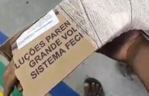 UPA de Quixadá utiliza caixa de papelão como tala em paciente