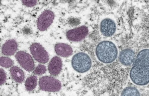 OMS declara mpox como emergência em saúde pública global