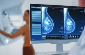 Médicos reafirmam eficácia da mamografia para prevenir câncer de mama