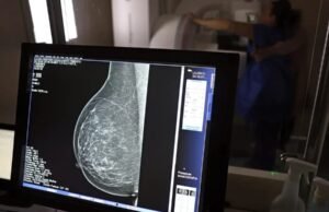 Entidades médicas querem que ANS amplie mamografia de rastreio para mulheres de 40 a 74 anos
