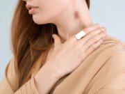 Chupão no pescoço pode levar a um AVC; entenda