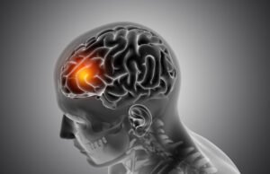 AVC mata uma pessoa a cada 6 minutos no Brasil