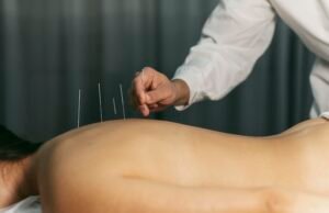 16º Congresso Brasileiro de Acupuntura será realizado em Fortaleza, de 13 a 16 de novembro