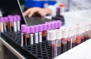 Ministério da Saúde investe R$ 6,5 milhões na Hemorrede do Ceará; confira municípios beneficiados com novos serviços