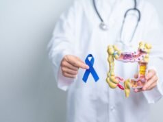 Março Azul: câncer colorretal é o 2º mais frequente no Brasil