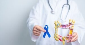 Março Azul: câncer colorretal é o 2º mais frequente no Brasil
