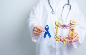 Março Azul: câncer colorretal é o 2º mais frequente no Brasil
