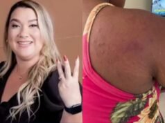 Empresária agride e tortura empregada grávida de 19 anos por suspeita de roubo