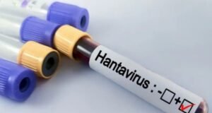 Paraná confirma dois casos de hantavírus e monitora outras 11 suspeitas
