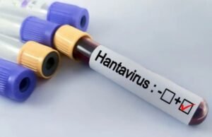 Paraná confirma dois casos de hantavírus e monitora outras 11 suspeitas