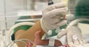 Leite humano fortalece proteção natural de prematuros, orienta nutricionista do Hospital Regional Norte