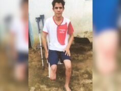 Servidor público simula assalto e amputa o próprio pé para receber R$ 1,5 milhão em indenizações