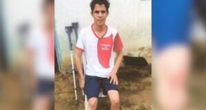 Servidor público simula assalto e amputa o próprio pé para receber R$ 1,5 milhão em indenizações