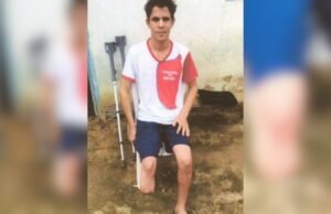 Servidor público simula assalto e amputa o próprio pé para receber R$ 1,5 milhão em indenizações
