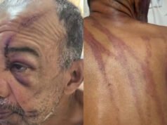 Homem denuncia racismo e tentativa de homicídio após agressão na Praia do Futuro, em Fortaleza