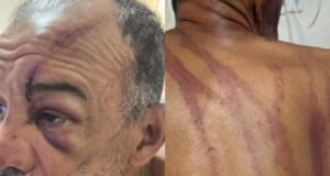 Homem denuncia racismo e tentativa de homicídio após agressão na Praia do Futuro, em Fortaleza