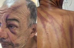 Homem denuncia racismo e tentativa de homicídio após agressão na Praia do Futuro, em Fortaleza